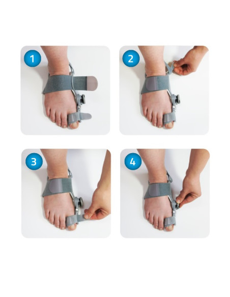 Regulowany aparat korygujący haluksa Mazbit CORRECTOR PRO MS518