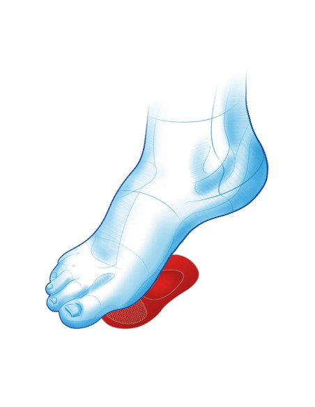 Półwkładki żelowe z pelotą metatarsalną, odciążające i amortyzujące przodostopie na płaskostopie poprzeczne Mazbit Step Gel