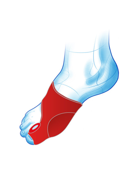 Opaska z klinem i osłoną na haluksy Mazbit Haluks Cover Plus MS520 para