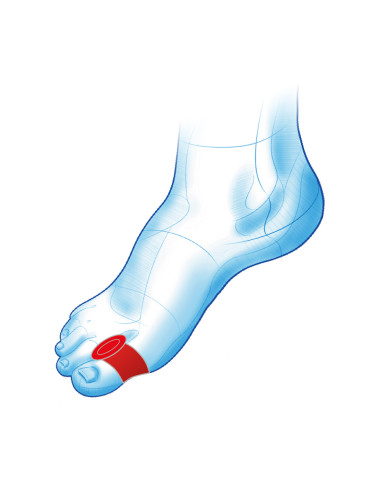 Kliny żelowe na halluksy z pierścieniem na paluch Haluks Duo